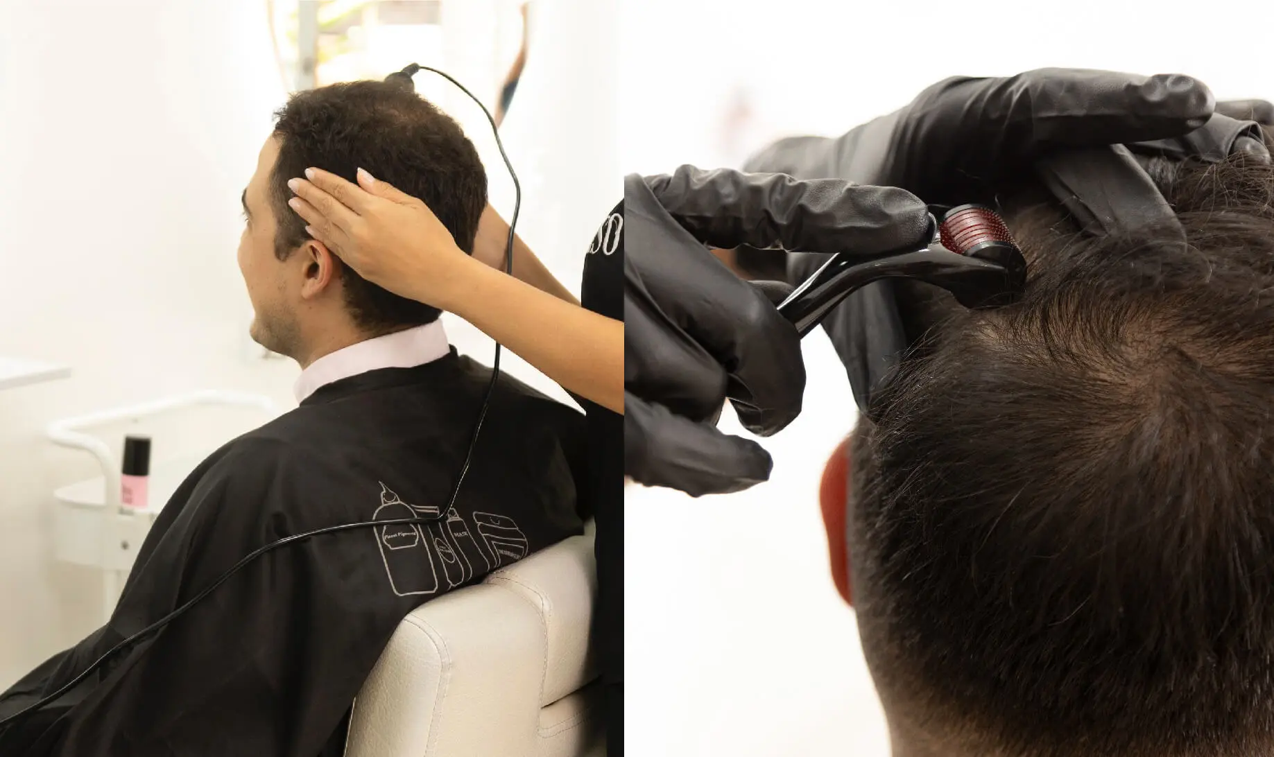 Terapia de fortalecimiento folicular - Servicios - Dra Liso